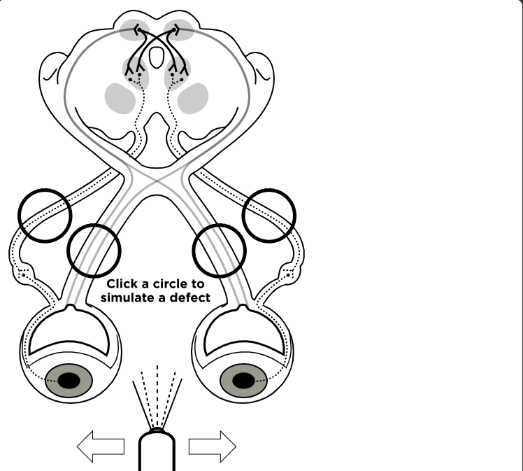 Pupillary Pathways